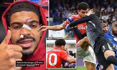 Morgan Gibbs White shows off result of his horror head injury during Nottingham Forest's win at Chelsea - just days before Europa League semi-final second leg against Aston Villa
